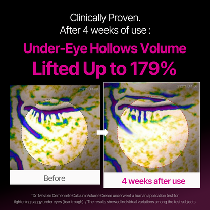 Cemenrete Calcium Eyecare Routine
