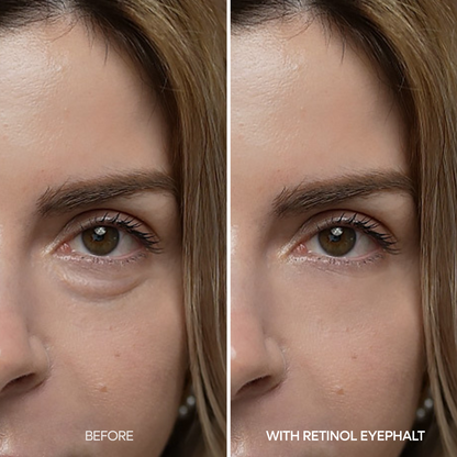 Retinol Eyebag Cream